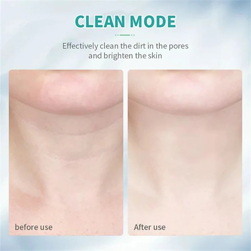 01 / DERM-IONIC JAWLINE CONTOURING LIFTER